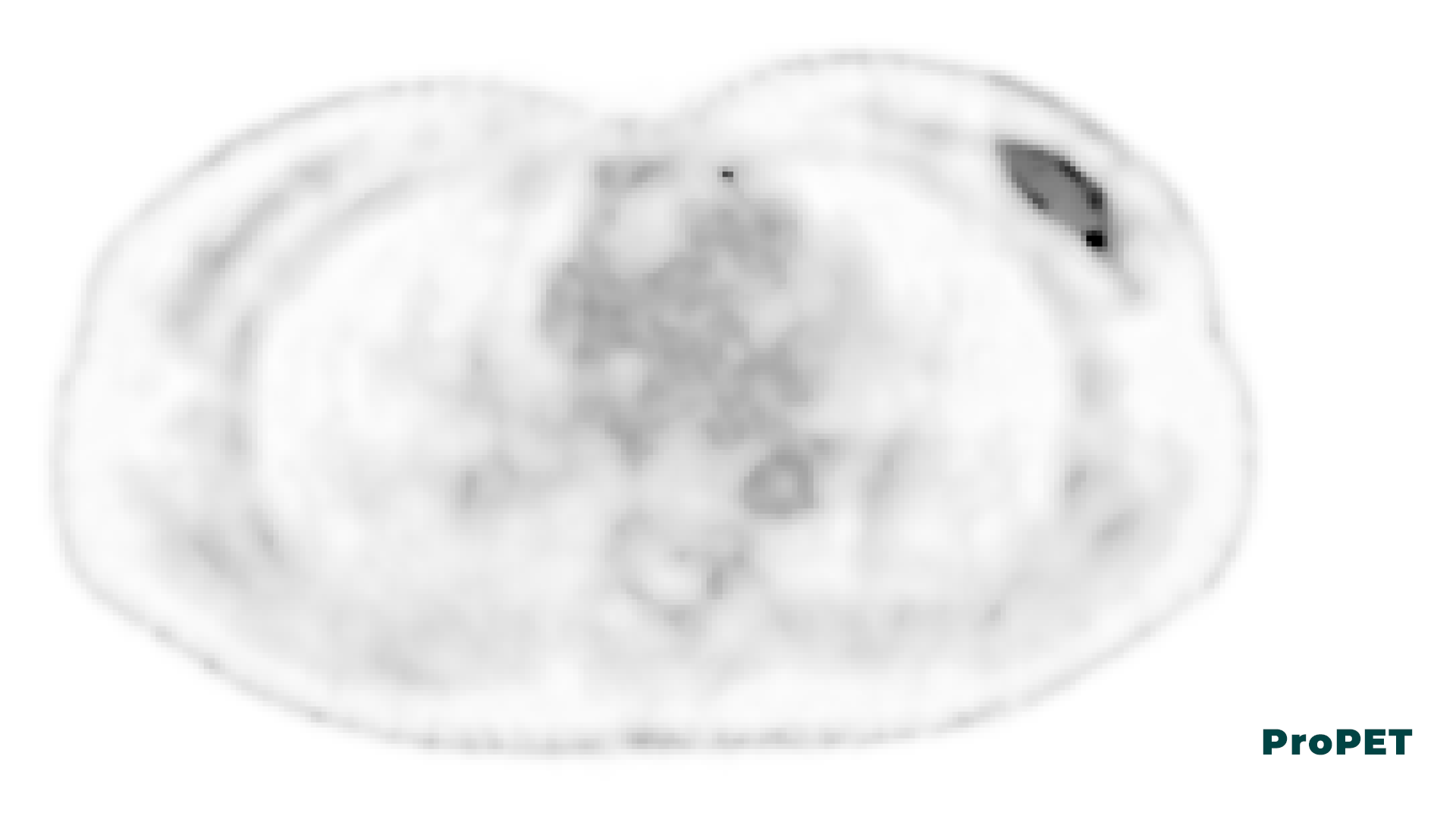 Skanning_02_ProPET